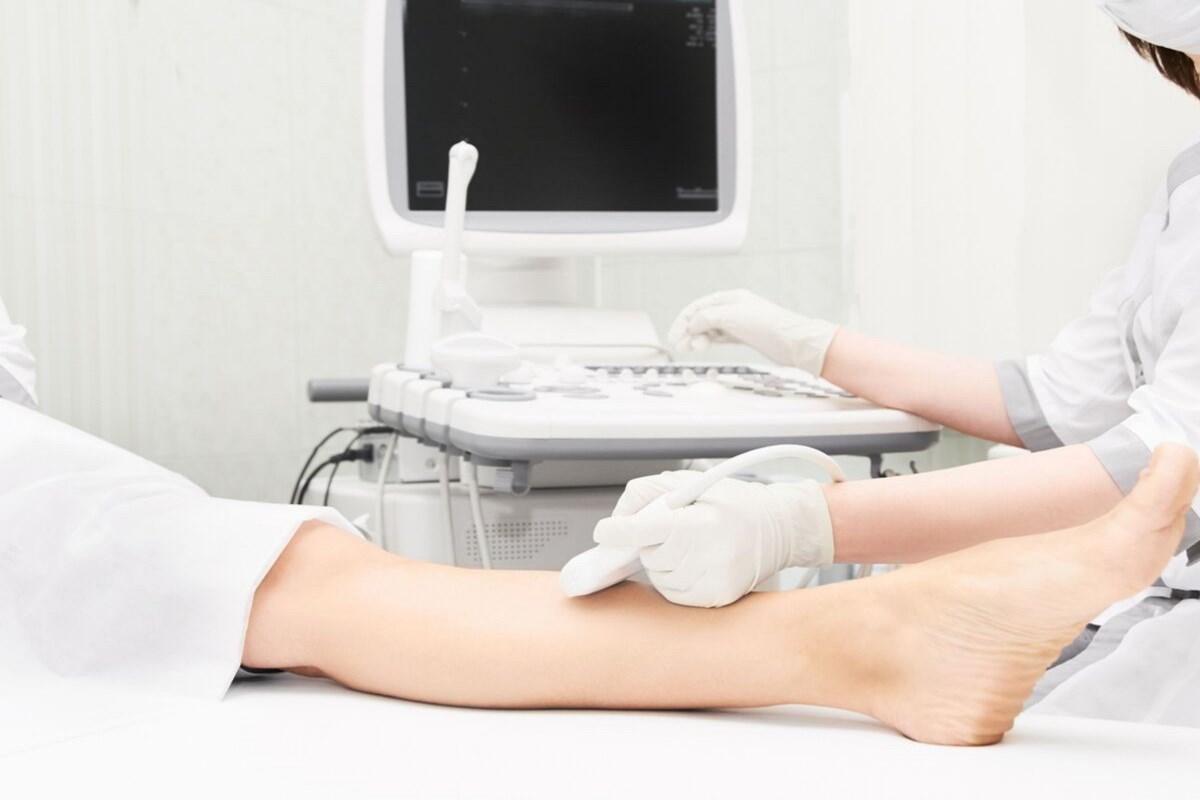 Échographie Doppler Vasculaire